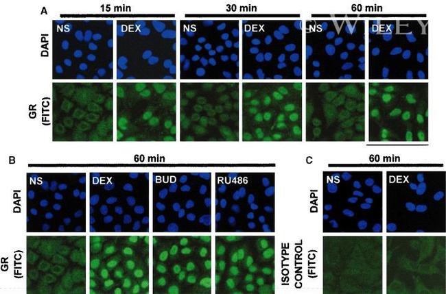 Glucocorticoid Receptor Antibody in Immunocytochemistry (ICC/IF)