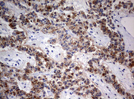 FEN1 Antibody in Immunohistochemistry (Paraffin) (IHC (P))