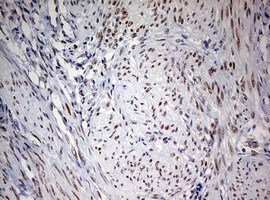 FEN1 Antibody in Immunohistochemistry (Paraffin) (IHC (P))