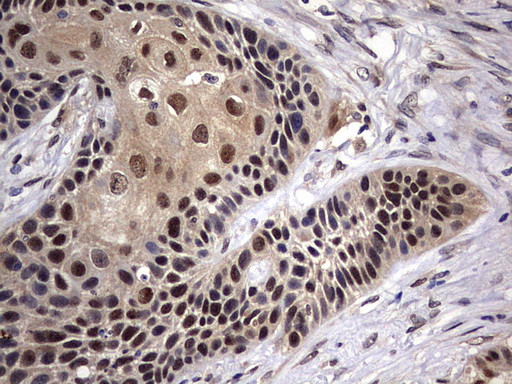 FEN1 Antibody in Immunohistochemistry (Paraffin) (IHC (P))