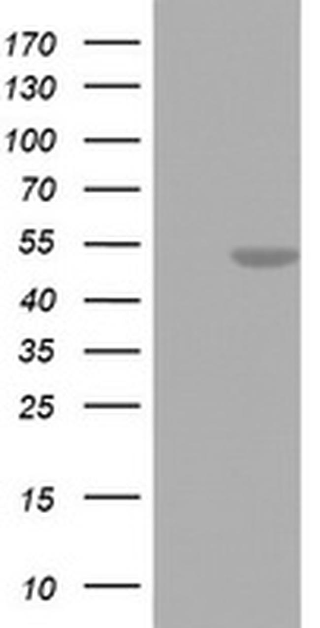 FEN1 Antibody in Western Blot (WB)