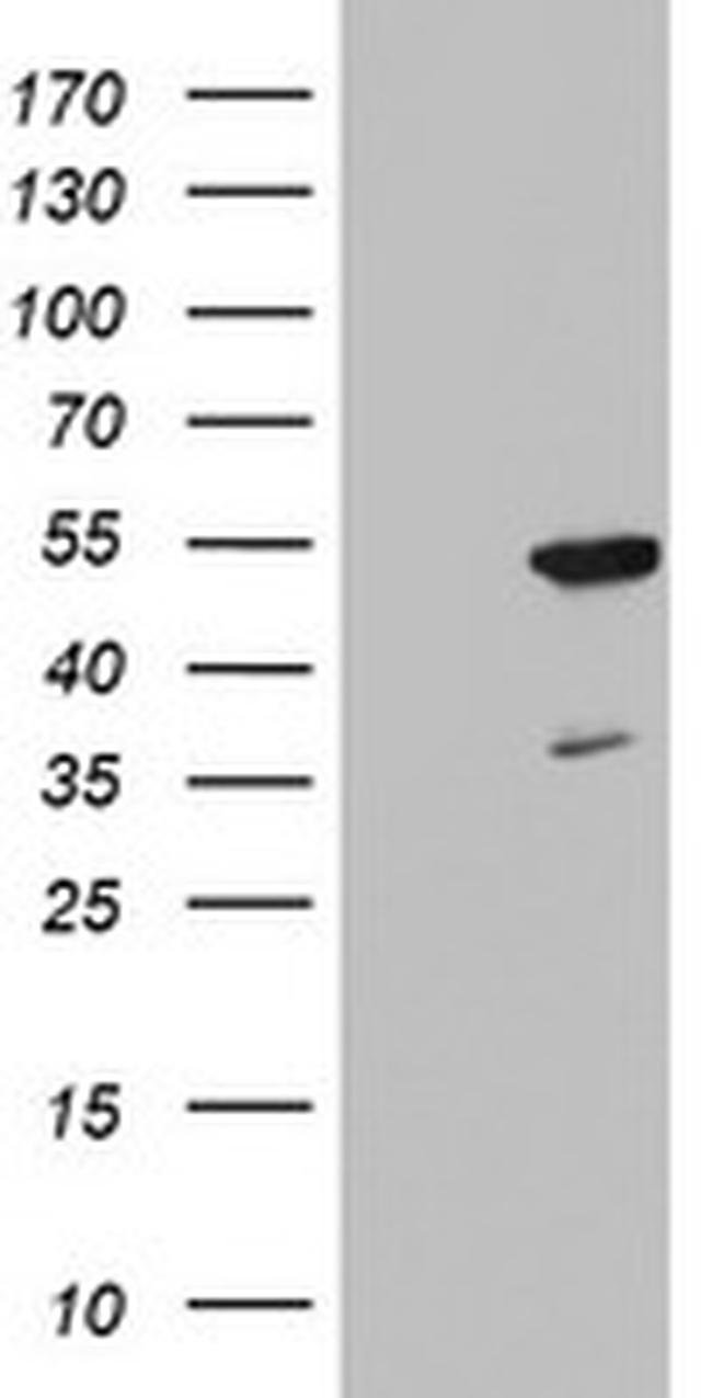 FEN1 Antibody in Western Blot (WB)