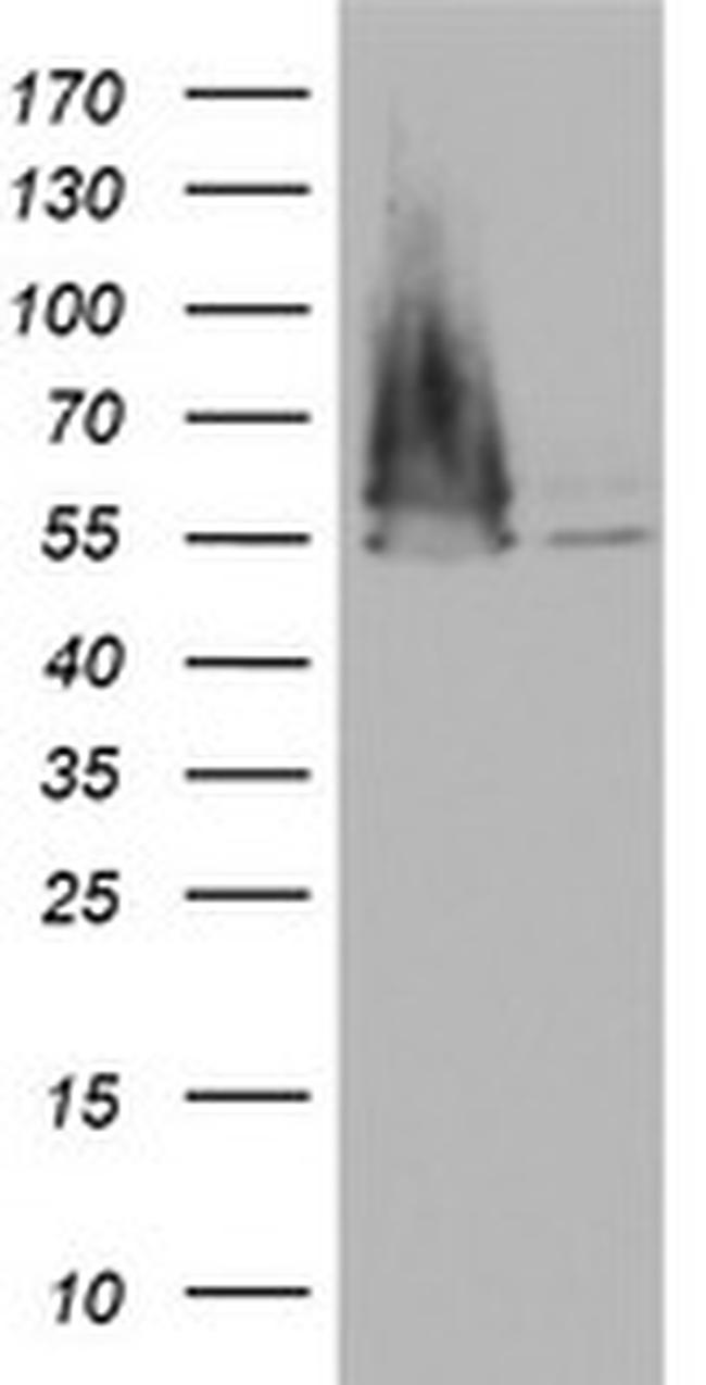 FEN1 Antibody in Western Blot (WB)