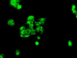 FERMT2 Antibody in Immunocytochemistry (ICC/IF)