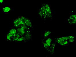 FERMT2 Antibody in Immunocytochemistry (ICC/IF)