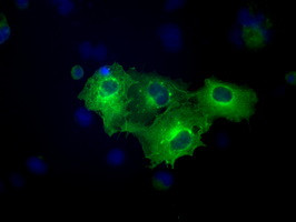 FERMT2 Antibody in Immunocytochemistry (ICC/IF)