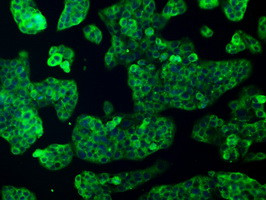 FERMT2 Antibody in Immunocytochemistry (ICC/IF)