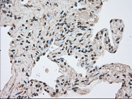 FERMT2 Antibody in Immunohistochemistry (Paraffin) (IHC (P))