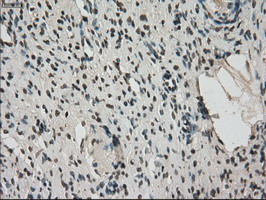 FERMT2 Antibody in Immunohistochemistry (Paraffin) (IHC (P))