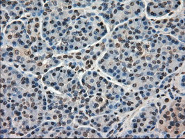 FERMT2 Antibody in Immunohistochemistry (Paraffin) (IHC (P))