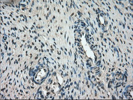 FERMT2 Antibody in Immunohistochemistry (Paraffin) (IHC (P))