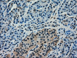 FERMT2 Antibody in Immunohistochemistry (Paraffin) (IHC (P))