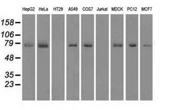 FERMT2 Antibody in Western Blot (WB)