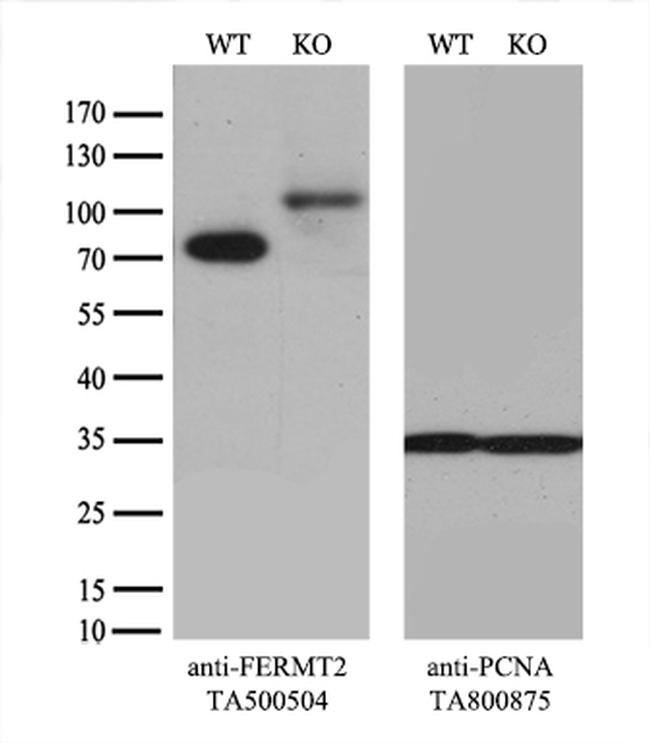 FERMT2 Antibody in Western Blot (WB)