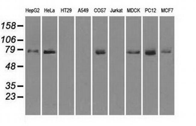 FERMT2 Antibody in Western Blot (WB)