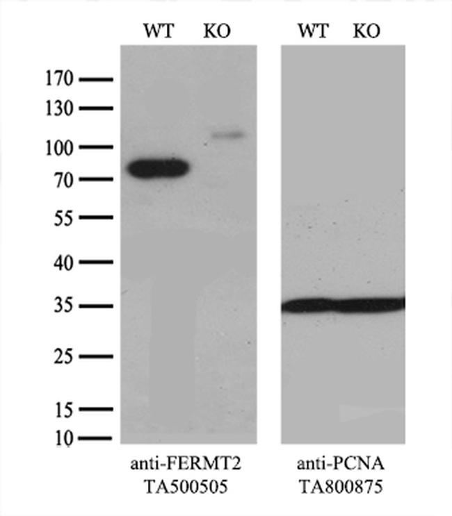 FERMT2 Antibody in Western Blot (WB)