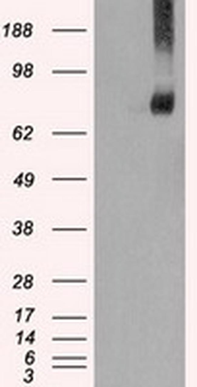 FERMT2 Antibody in Western Blot (WB)