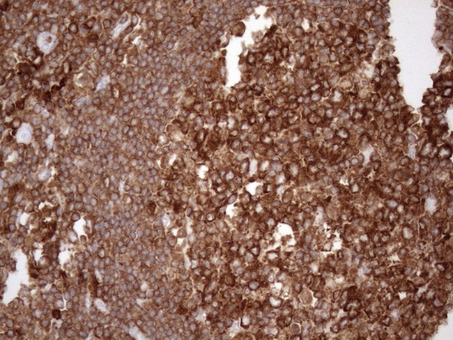 FERMT3 Antibody in Immunohistochemistry (Paraffin) (IHC (P))