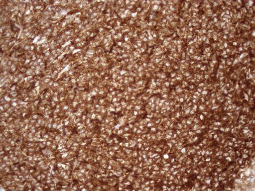 FERMT3 Antibody in Immunohistochemistry (Paraffin) (IHC (P))