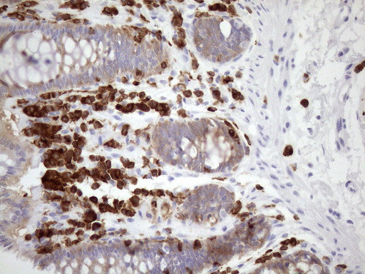 FERMT3 Antibody in Immunohistochemistry (Paraffin) (IHC (P))