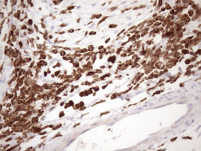 FERMT3 Antibody in Immunohistochemistry (Paraffin) (IHC (P))