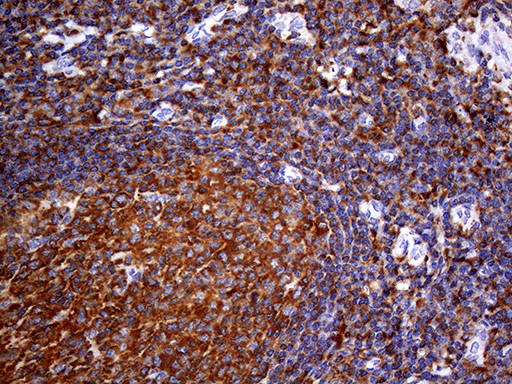 FERMT3 Antibody in Immunohistochemistry (Paraffin) (IHC (P))