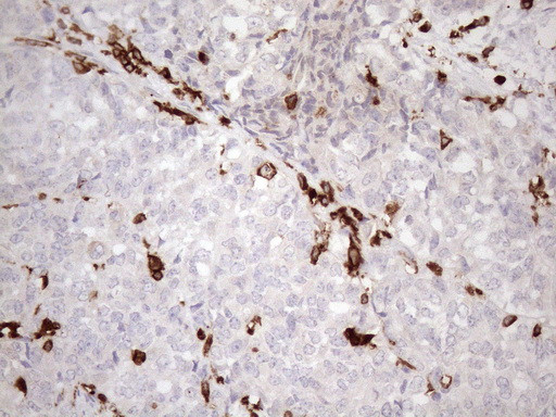 FERMT3 Antibody in Immunohistochemistry (Paraffin) (IHC (P))