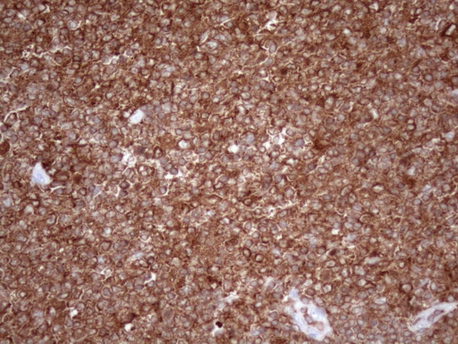 FERMT3 Antibody in Immunohistochemistry (Paraffin) (IHC (P))