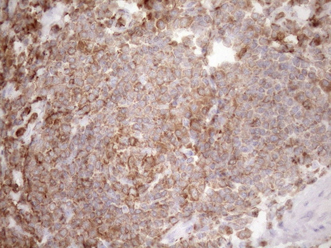 FERMT3 Antibody in Immunohistochemistry (Paraffin) (IHC (P))