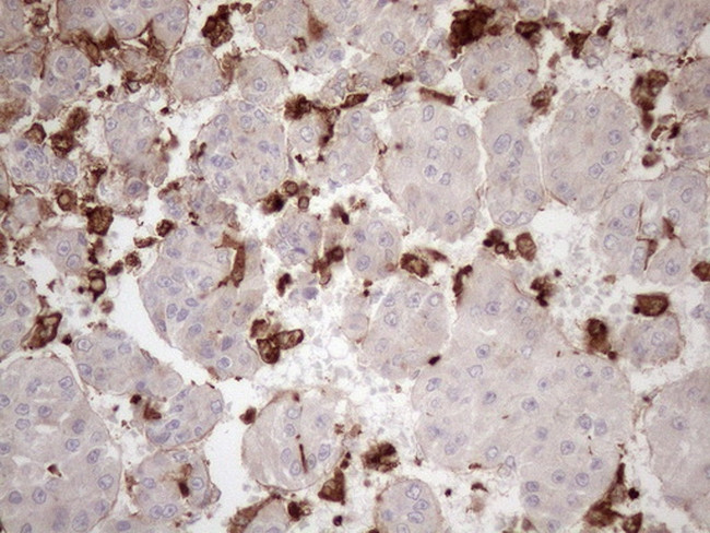 FERMT3 Antibody in Immunohistochemistry (Paraffin) (IHC (P))