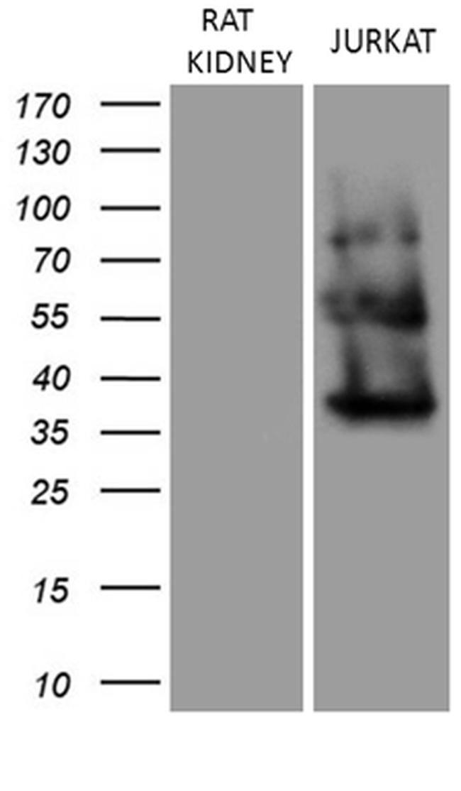 FERMT3 Antibody in Western Blot (WB)