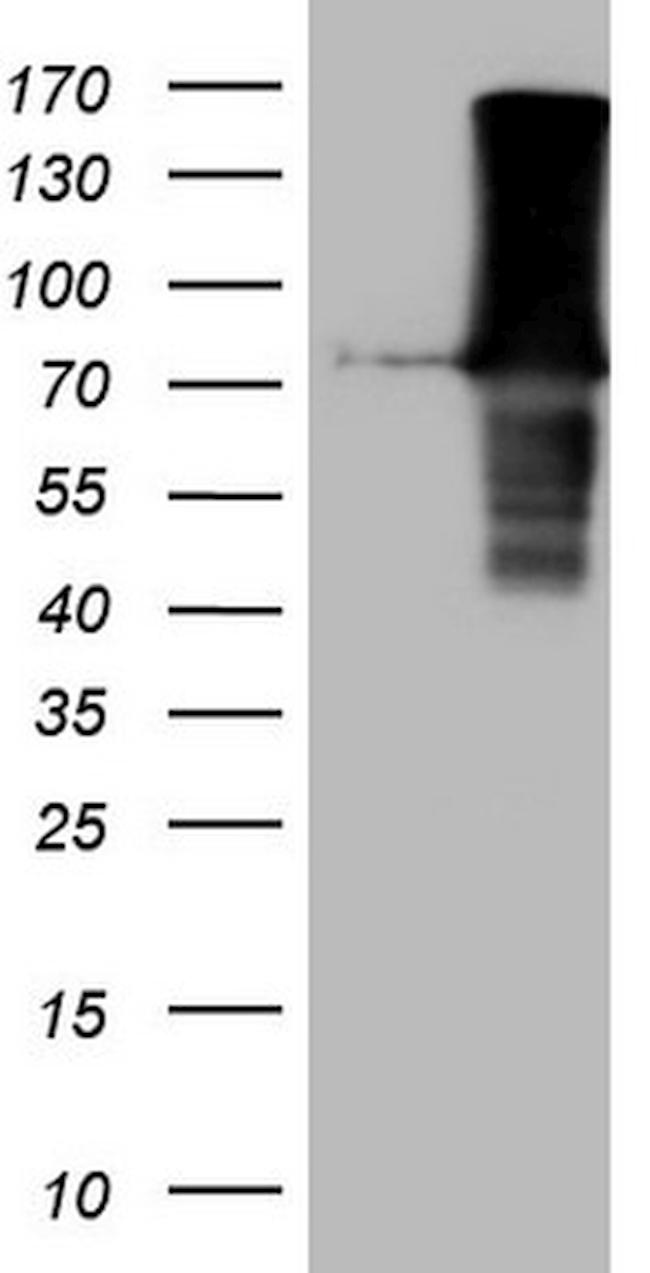 FERMT3 Antibody in Western Blot (WB)