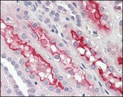 FER Antibody in Immunohistochemistry (Paraffin) (IHC (P))