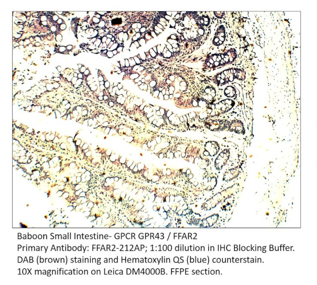 GPCR GPR43/FFAR2 Antibody in Immunohistochemistry (IHC)