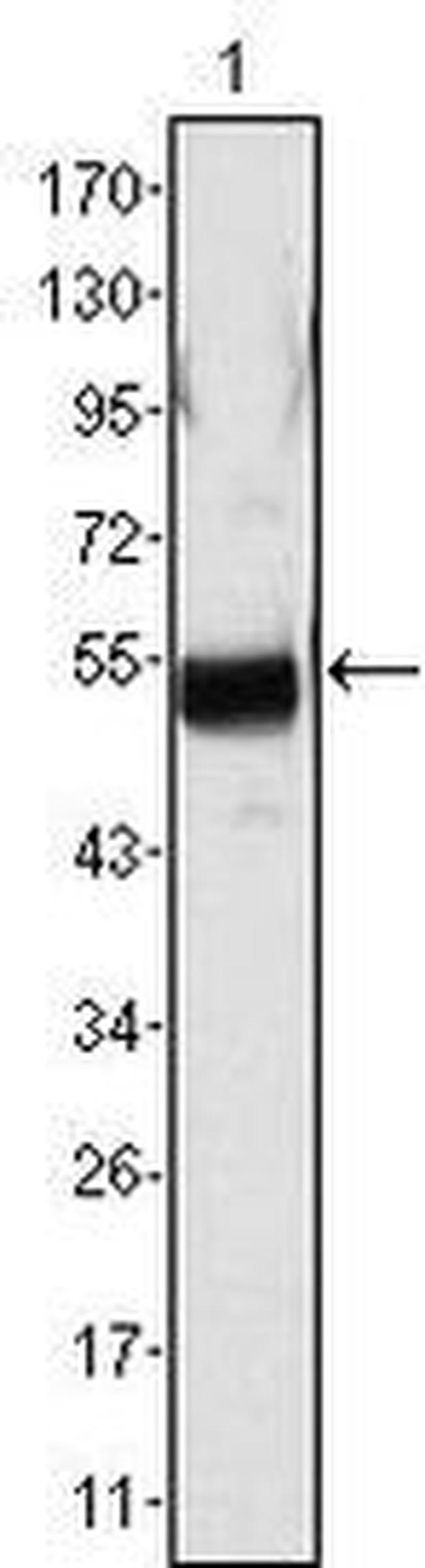 FIBB Antibody in Western Blot (WB)