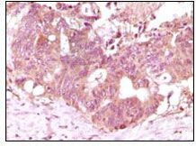 FGF2 Antibody in Immunohistochemistry (Paraffin) (IHC (P))