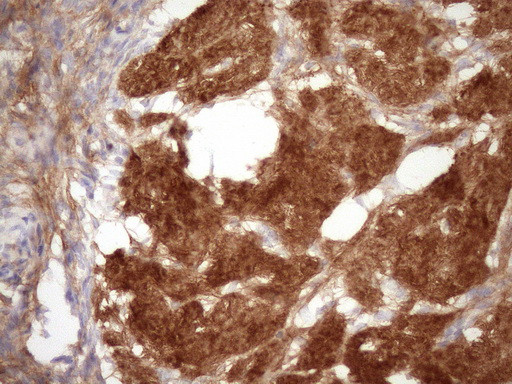 FGFBP1 Antibody in Immunohistochemistry (Paraffin) (IHC (P))