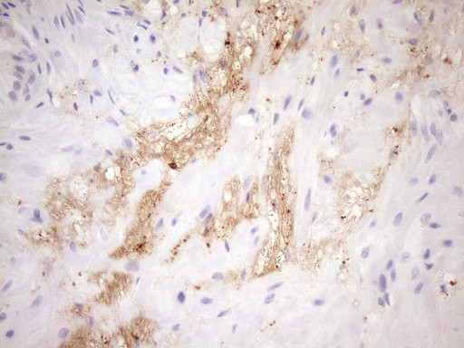 FGFBP1 Antibody in Immunohistochemistry (Paraffin) (IHC (P))