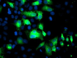 FGFR2 Antibody in Immunocytochemistry (ICC/IF)