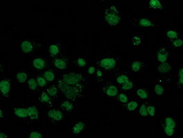 FGFR2 Antibody in Immunocytochemistry (ICC/IF)