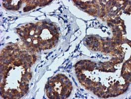 FGFR2 Antibody in Immunohistochemistry (Paraffin) (IHC (P))