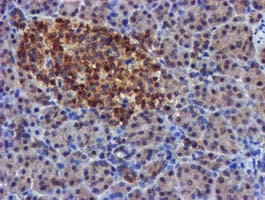 FGFR2 Antibody in Immunohistochemistry (Paraffin) (IHC (P))