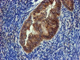 FGFR2 Antibody in Immunohistochemistry (Paraffin) (IHC (P))