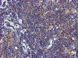 FGFR2 Antibody in Immunohistochemistry (Paraffin) (IHC (P))