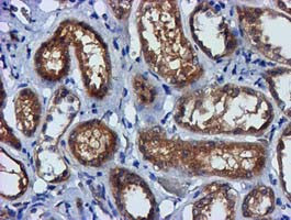 FGFR2 Antibody in Immunohistochemistry (Paraffin) (IHC (P))