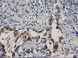 FGFR2 Antibody in Immunohistochemistry (Paraffin) (IHC (P))