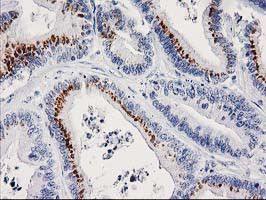 FGFR2 Antibody in Immunohistochemistry (Paraffin) (IHC (P))