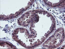 FGFR2 Antibody in Immunohistochemistry (Paraffin) (IHC (P))