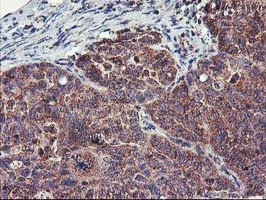 FGFR2 Antibody in Immunohistochemistry (Paraffin) (IHC (P))