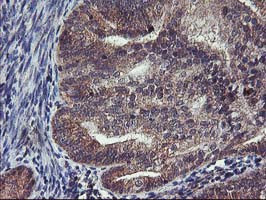 FGFR2 Antibody in Immunohistochemistry (Paraffin) (IHC (P))